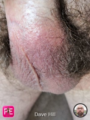 close_up — Dave Hill